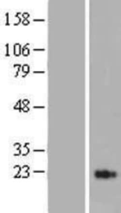Novus Biologicals&trade;&nbsp;MASP2 Overexpression Lysate