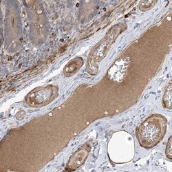 MASP2 Antibody, Novus Biologicals 0.1mL; Unlabeled:Antibodies, Polyclonal
