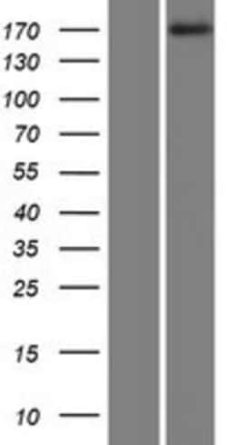 Novus Biologicals&trade;&nbsp;MAST1 Overexpression Lysate