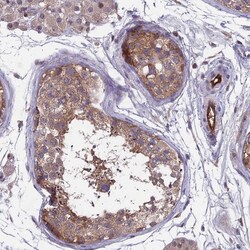MAST205 Antibody, Novus Biologicals 25 &mu;L; Unlabeled:Antibodies, Polyclonal