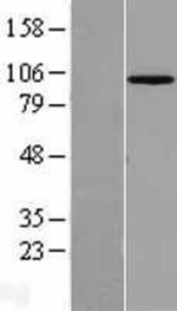 Novus Biologicals&trade;&nbsp;MASTL Overexpression Lysate