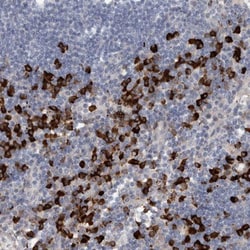MASTL Antibody, Novus Biologicals 0.1mL; Unlabeled:Antibodies, Polyclonal