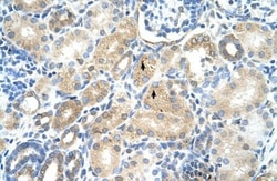MAT1A Antibody, Novus Biologicals 0.1mg; Unlabeled:Antibodies, Polyclonal