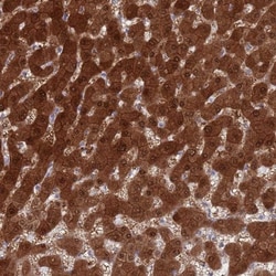 MAT1A Antibody, Novus Biologicals 0.1mL; Unlabeled:Antibodies, Polyclonal