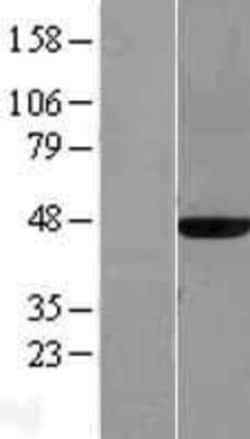 Novus Biologicals&trade;&nbsp;MAT2A Overexpression Lysate
