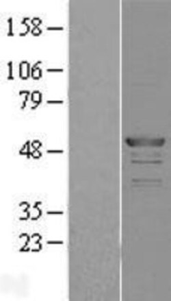 Novus Biologicals&trade;&nbsp;MATH1 Overexpression Lysate