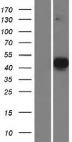 Novus Biologicals&trade;&nbsp;MATH2/NEUROD6 Overexpression Lysate
