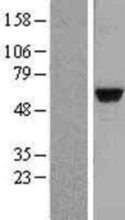 Novus Biologicals&trade;&nbsp;MATK Overexpression Lysate