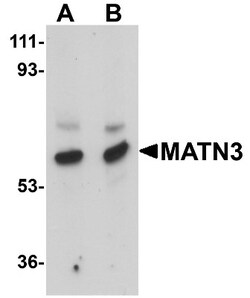MATN3 Antibody - BSA Free, Novus Biologicals 0.1mg; Unlabeled:Antibodies,