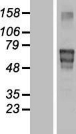 Novus Biologicals&trade;&nbsp;Matrilin-4 Overexpression Lysate