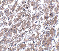 Matrilin-1 Antibody - BSA Free, Novus Biologicals 0.1mg; Unlabeled:Antibodies,