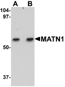 Matrilin-1 Antibody - BSA Free, Novus Biologicals 0.1mg; Unlabeled:Antibodies,