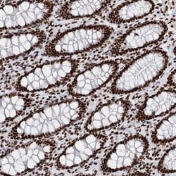 Matrin 3 Antibody, Novus Biologicals 25 &mu;L | Buy Online | Novus Biologicals | Fisher Scientific