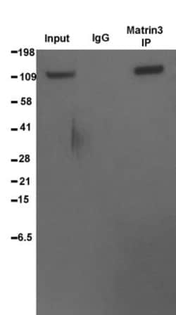 Matrin 3 Antibody, Novus Biologicals 0.1mL; Unlabeled:Antibodies, Polyclonal