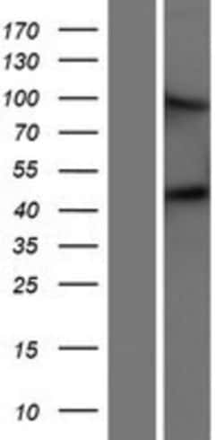 Novus Biologicals&trade;&nbsp;Matriptase 2 Overexpression Lysate