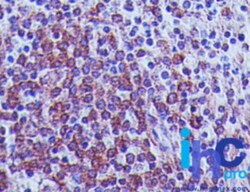 MAVS Antibody (58N3B6) - BSA Free, Novus Biologicals 0.1mg; Unlabeled:Antibodies,