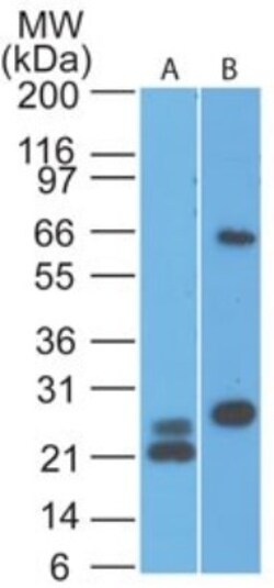 MAVS Antibody (58N3E1), Novus Biologicals 0.025mg; Unlabeled:Antibodies,