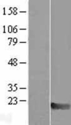 Novus Biologicals&trade;&nbsp;Max Overexpression Lysate