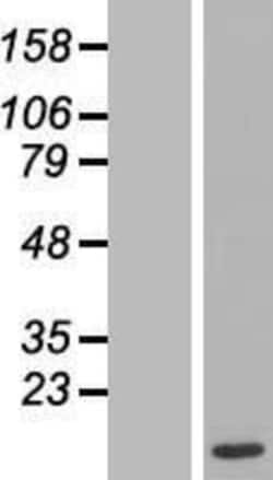 Novus Biologicals&trade;&nbsp;Max Overexpression Lysate