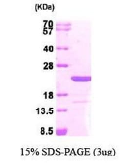 Novus Biologicals&trade;&nbsp;Recombinant Human Max His Protein