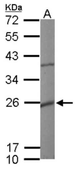 Maxi Potassium channel beta Antibody, Novus Biologicals 0.1mg; Unlabeled:Antibodies,
