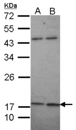 Maxi Potassium channel beta Antibody, Novus Biologicals 0.1mg; Unlabeled:Antibodies,
