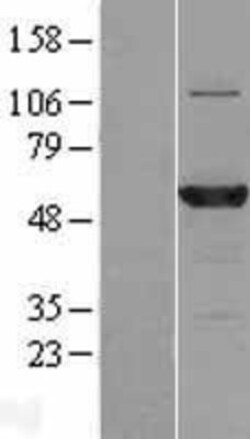 Novus Biologicals&trade;&nbsp;MB21D2 Overexpression Lysate