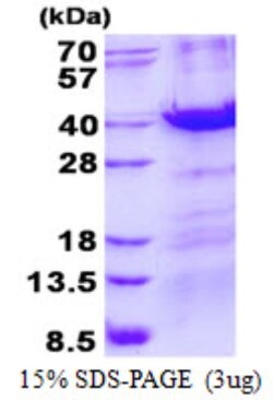 Novus Biologicals&trade;&nbsp;Recombinant Human MBD3 His Protein