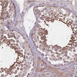 MBD3L1 Antibody, Novus Biologicals 25 &mu;L, Unlabeled:Antibodies, Polyclonal