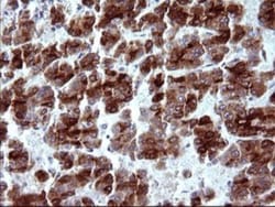 MBL Antibody (OTI1A12), Novus Biologicals 0.1mL; Unlabeled:Antibodies,