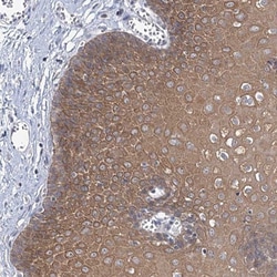 MBLAC2 Antibody, Novus Biologicals:Antibodies:Primary Antibodies