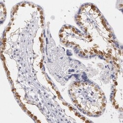 MBNL3 Antibody, Novus Biologicals 0.1mL; Unlabeled:Antibodies, Polyclonal
