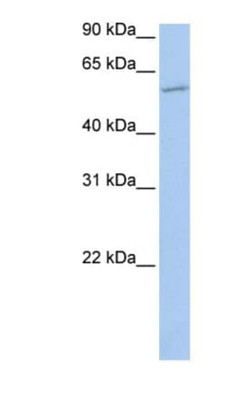 MBOAT1 Antibody, Novus Biologicals:Antibodies:Primary Antibodies