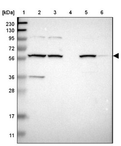MBOAT2 Antibody, Novus Biologicals 0.1mL; Unlabeled:Antibodies, Polyclonal