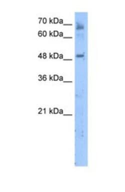MBOAT7 Antibody, Novus Biologicals 0.1mg; Unlabeled:Antibodies, Polyclonal