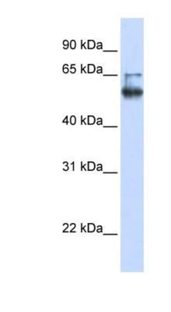 MBOAT7 Antibody, Novus Biologicals 0.05mg; Unlabeled:Antibodies, Polyclonal