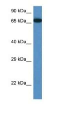 MBTD1 Antibody, Novus Biologicals:Antibodies:Primary Antibodies