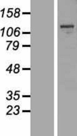 Novus Biologicals&trade;&nbsp;MBTPS1 Overexpression Lysate
