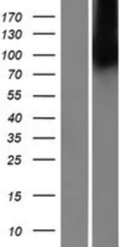 Novus Biologicals™ MBTPS2 Overexpression Lysate