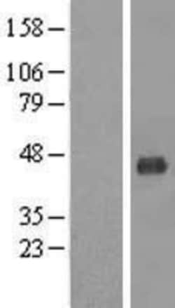 Novus Biologicals&trade;&nbsp;MCAT Overexpression Lysate