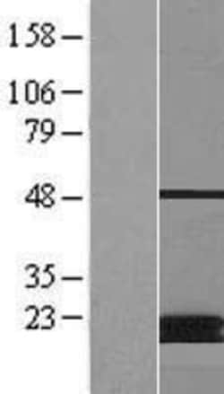 Novus Biologicals&trade;&nbsp;MCAT Overexpression Lysate