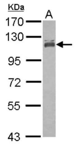 MCC Antibody, Novus Biologicals 0.1 mL | Buy Online | Novus Biologicals | Fisher Scientific