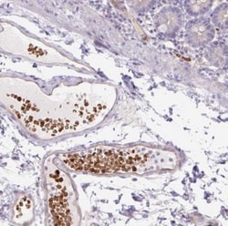 MCC2 Antibody, Novus Biologicals:Antibodies:Primary Antibodies