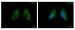MCCC2 Antibody, Novus Biologicals 0.1mL; Unlabeled:Antibodies, Polyclonal