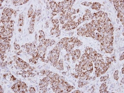 MCCC2 Antibody, Novus Biologicals 0.1mL; Unlabeled:Antibodies, Polyclonal