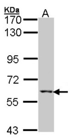 MCCC2 Antibody, Novus Biologicals 100 ul; Unconjugated:Antibodies, Polyclonal
