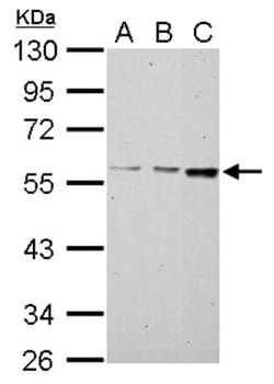 MCCC2 Antibody, Novus Biologicals 0.1mL; Unlabeled:Antibodies, Polyclonal