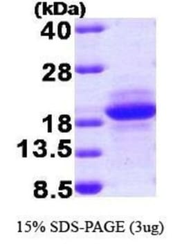 Novus Biologicals&trade;&nbsp;Recombinant Human SDNSF/MCFD2 T7 Protein