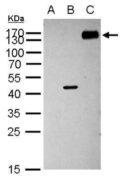 mCherry Antibody, Novus Biologicals 0.1mL:Antibodies, Polyclonal