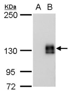 mCherry Antibody (235), Novus Biologicals 0.1mL; Unlabeled:Antibodies,